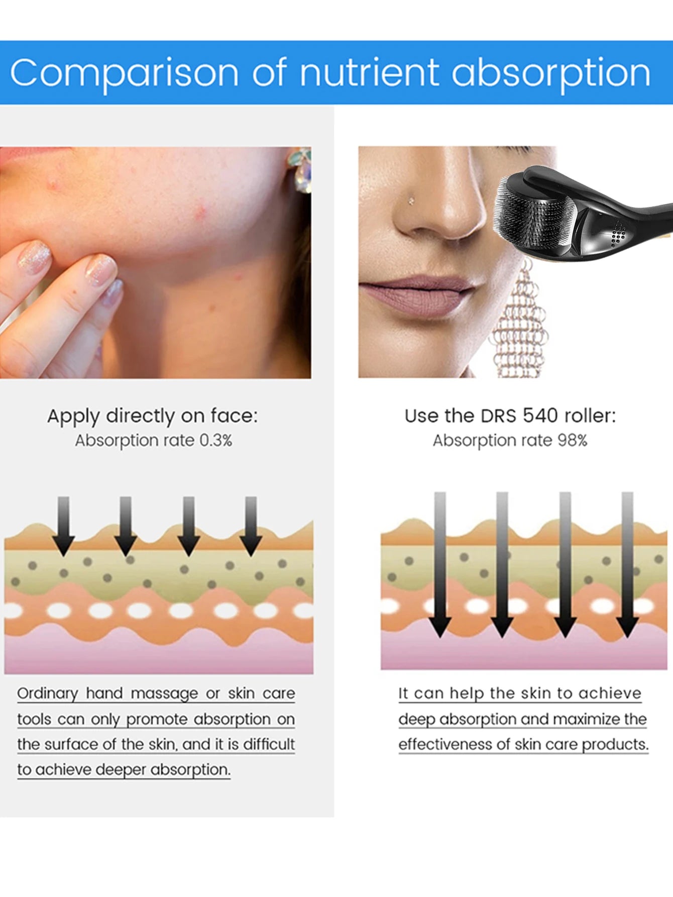 Derma Roller 540 Aiguilles – Anti-Cicatrices & Repousse – photo 11