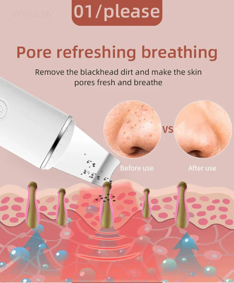 Spatule Ultrasonique – Pores Nets & Peau Purifiée – photo 10
